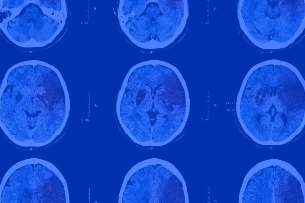 Neuralert Website